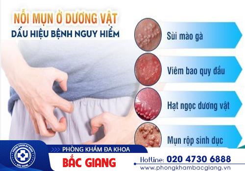 Mụn vùng kín và những nguyên nhân thường gặp