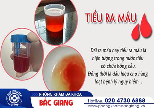 Tiểu ra máu báo hiệu điều gì?