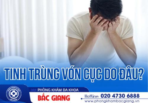 Những nguyên nhân gây nên tình trạng tinh trùng vón cục ở nam giới.